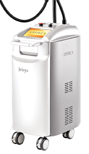 IPL治療(セレックV)