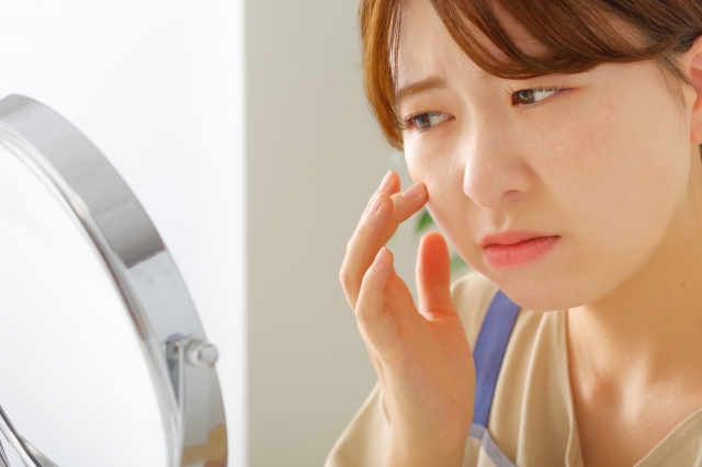 女性ホルモンと肝斑の関係