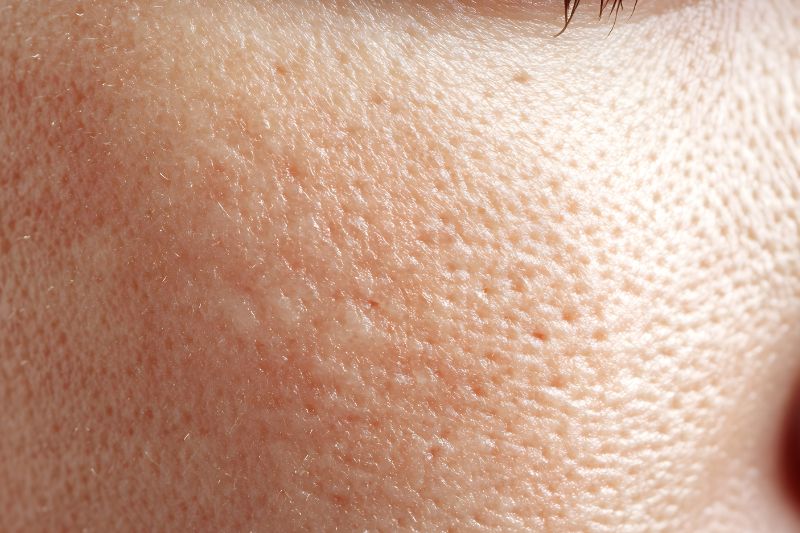 毛穴の開き・黒ずみ