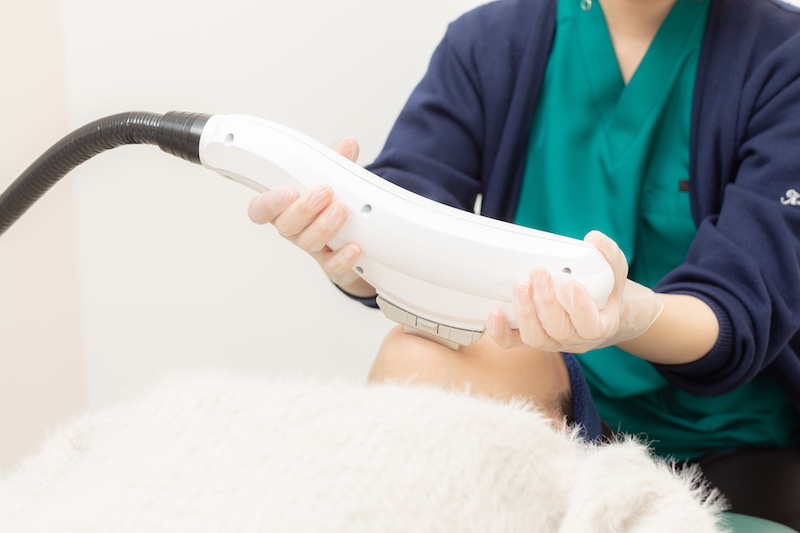 IPL（セレックV）の特徴